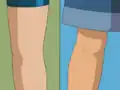 Max's miscolored leg