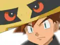 Gary's miscolored eye