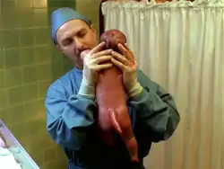 Small Potatoes