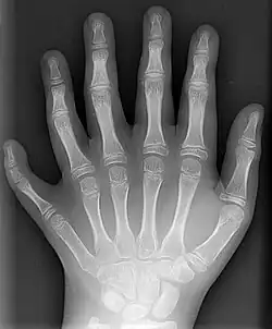 Source image JPEG grayscale (891×1,077 pixel, 119&nbsp;KB)