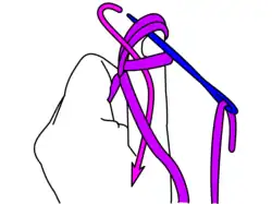 Mammen stitch