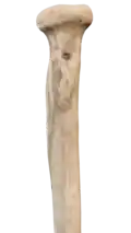 Medial view of right proximal radius