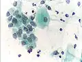Normal endocervical cells should be present into the slide, as a proof of a good quality sampling