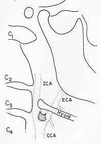 X-ray64B